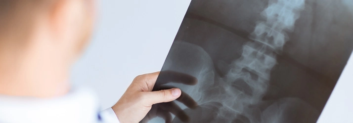 Chiropractic Oceanside CA X Rays